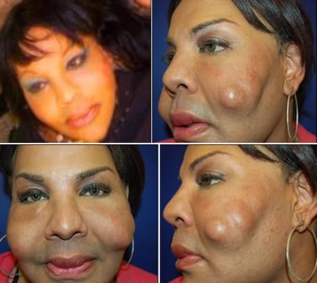 7. 这个女人被假医生在脸部注射了水泥。