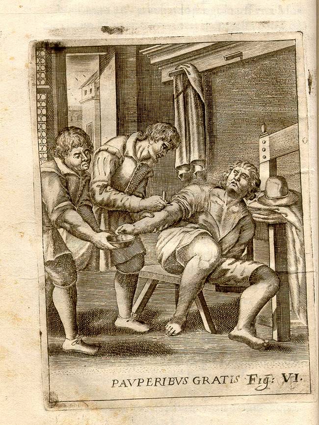 Barbers were the most likely to administer the bloodletting.
