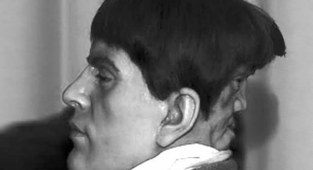 Edward Mordrake was born with a second face attached to the back of his head. The second face couldn't speak, but could laugh and cry separately from Edward's emotions...