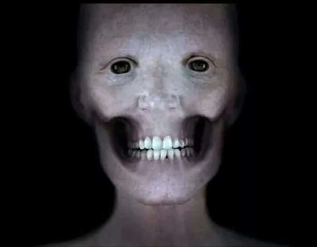 A human face without the muscles.