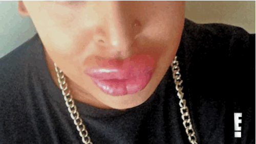 This Guy Spent $150,000 To Look Like Kim Kardashian And Now His Lips Are Leaking