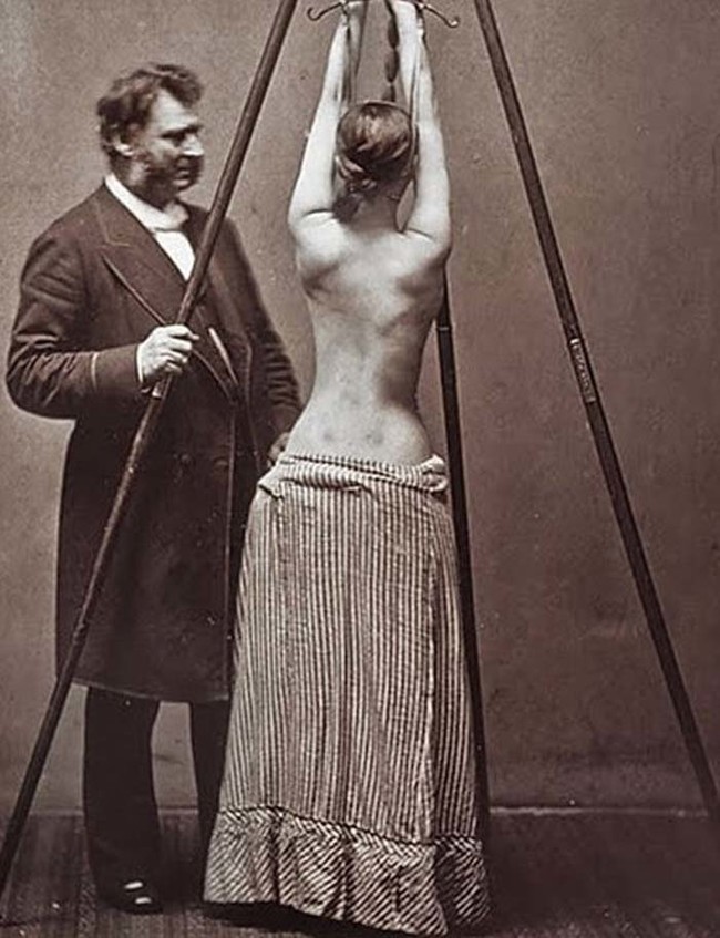 This isn't a scene from <em>50 Shades Of Grey --- </em>it's actually how they used to treat scoliosis.