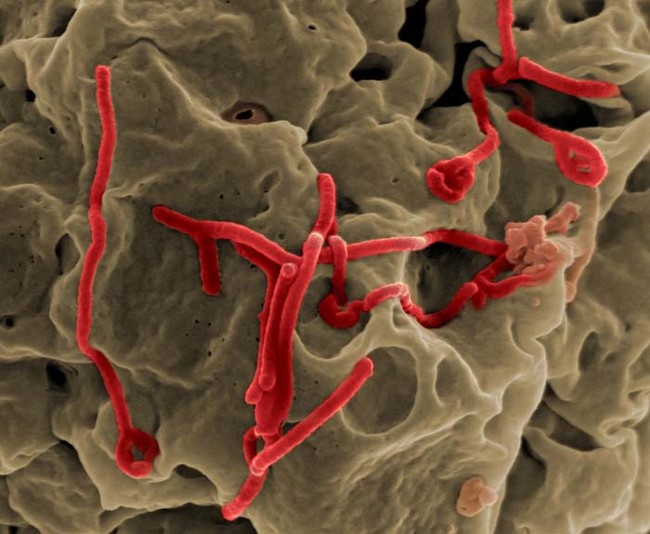 Those who survive an Ebola infection typically experience what researchers have come to call "post-Ebola syndrome."