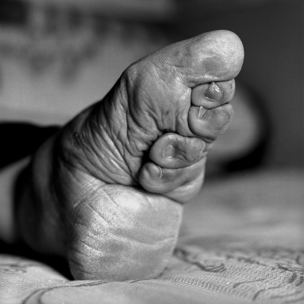 British photographer Jo Farrell is documenting a tradition that is dying out with China’s oldest women: foot binding.