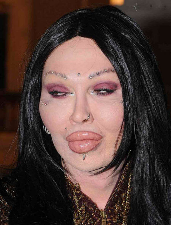 plastic surgery gone wrong 14