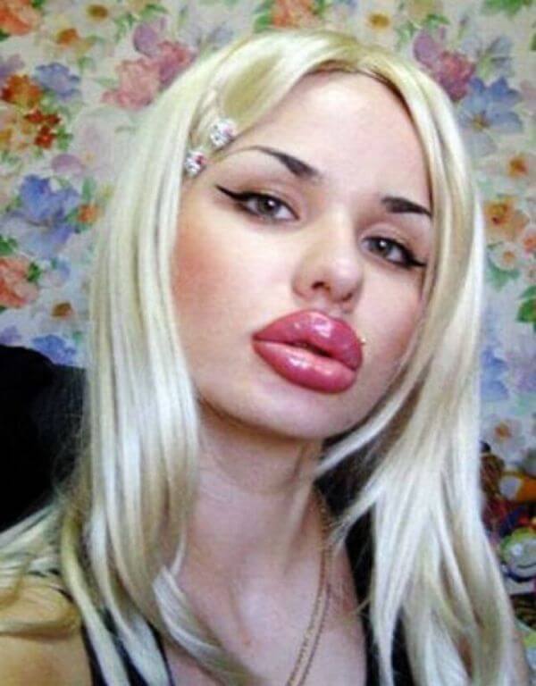 plastic surgery gone wrong 25