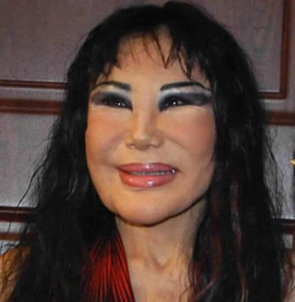 plastic surgery gone wrong 1