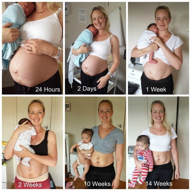 Julie Bhosale, a blogger and nutritionalist in New Zealand, decided to take these photos of herself after the birth of her second son to highlight what a “post-baby body” really looks like.