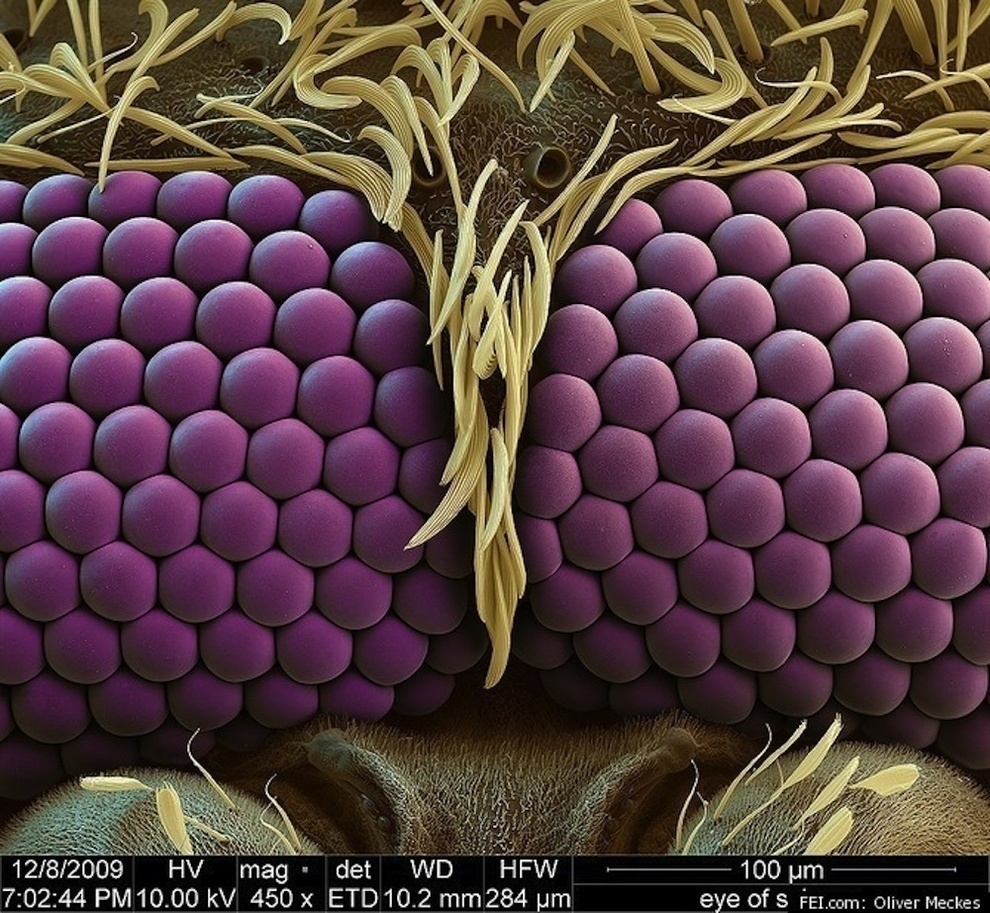 No, it's not a bunch of grapes: It's a mosquito's eyes.