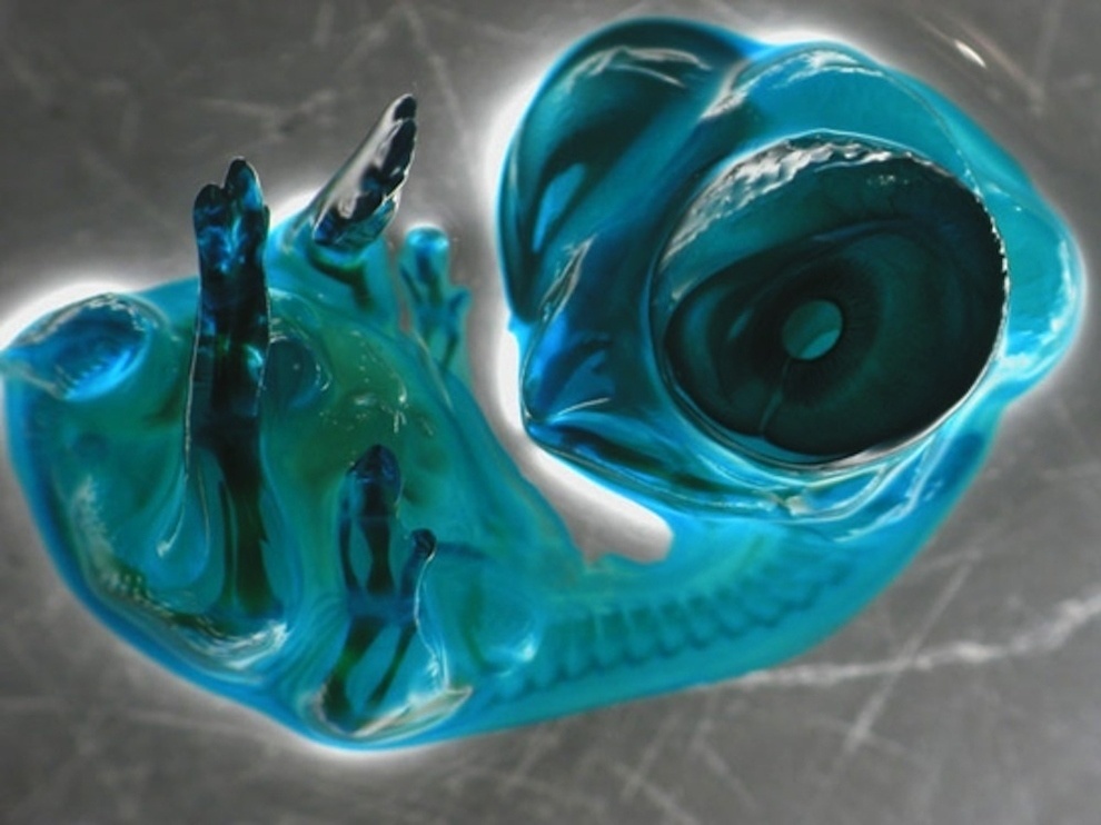 A magnified image of a chicken embryo.