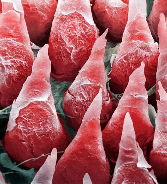 Here's the human tongue under a microscope - yikes.