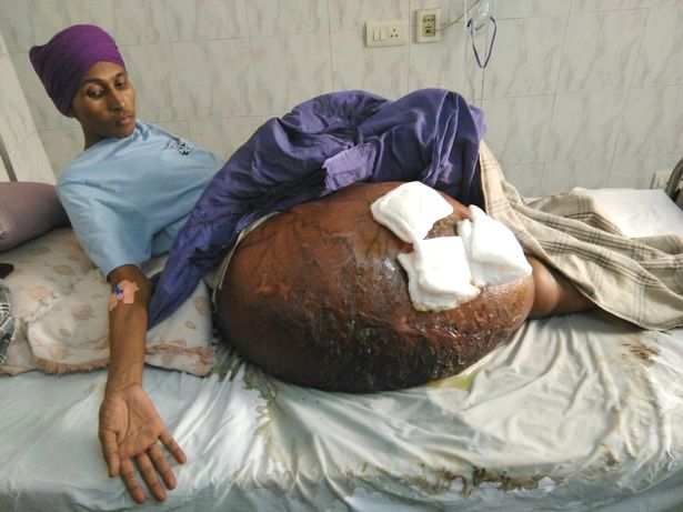 Gurmeet Singh pictured before his tumour surgery at Max hospital in New Delhi, India