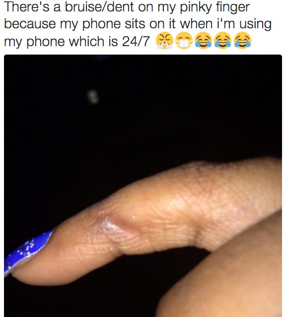 你每天都在看手機但沒有注意到，現在看看你的小指你才會知道可怕！