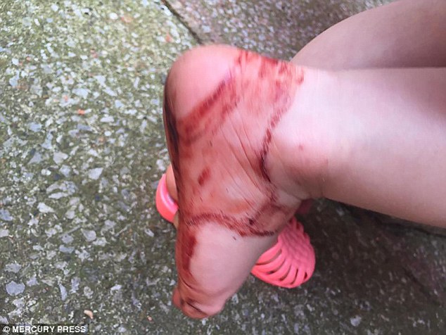 The toddler's foot was left with blood all over it after the £8 shoes caused her huge discomfort