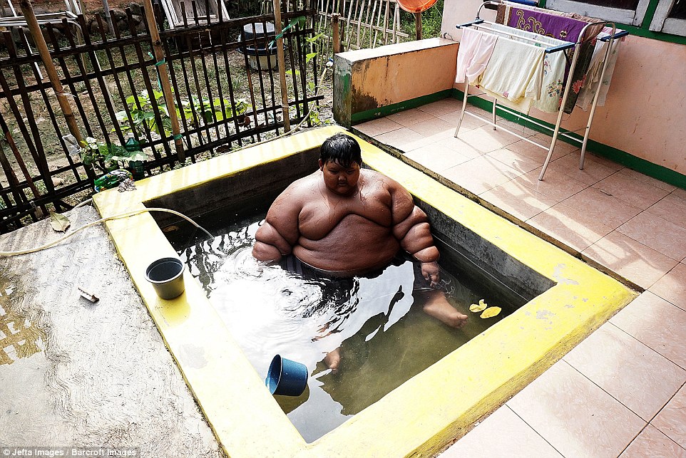 Arya Permana, named the world's fattest child, weighs an eye-watering 192 kilograms and eats five meals a day consisting of rice, fish, beef, vegetable soup and Tempeh