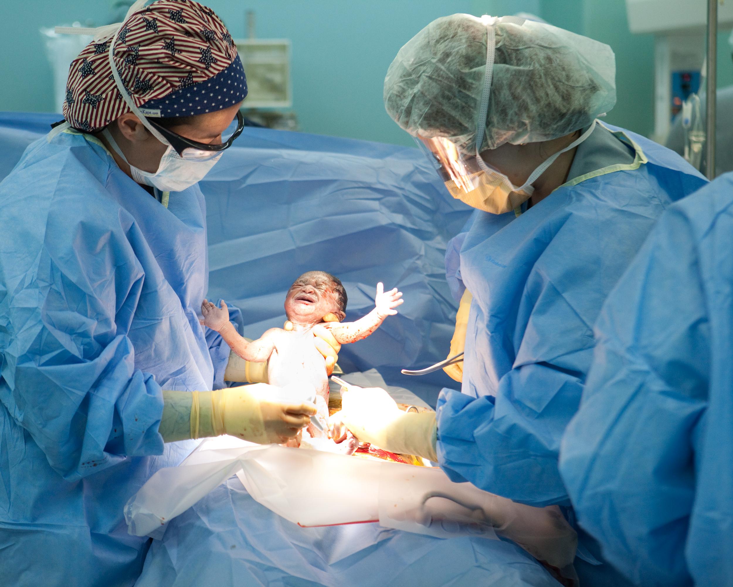 剖腹產現場紀錄全圖解→進入手術室拍攝，真實呈現！ | 嬰兒與母親