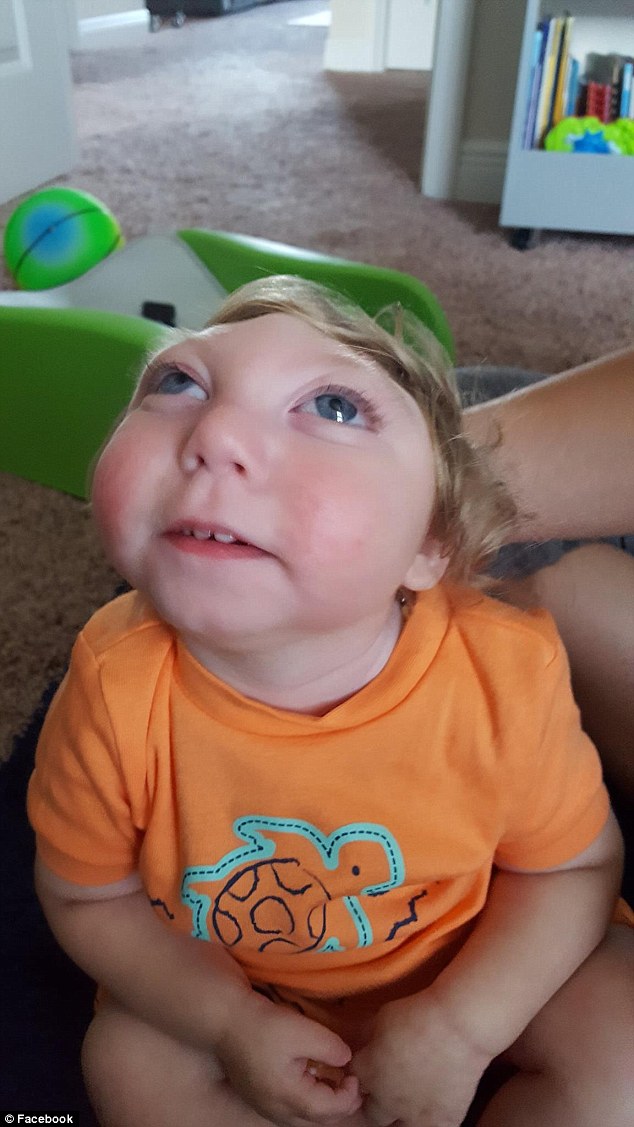 Jaxon Buell (pictured), who survived despite being born with most of his skull missing, has celebrated his second birthday