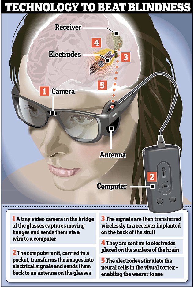 The diagram shows how the new bionic eye would work, sending signals directly to the brain. The computer sends signals to the antenna, which is connected to the brain