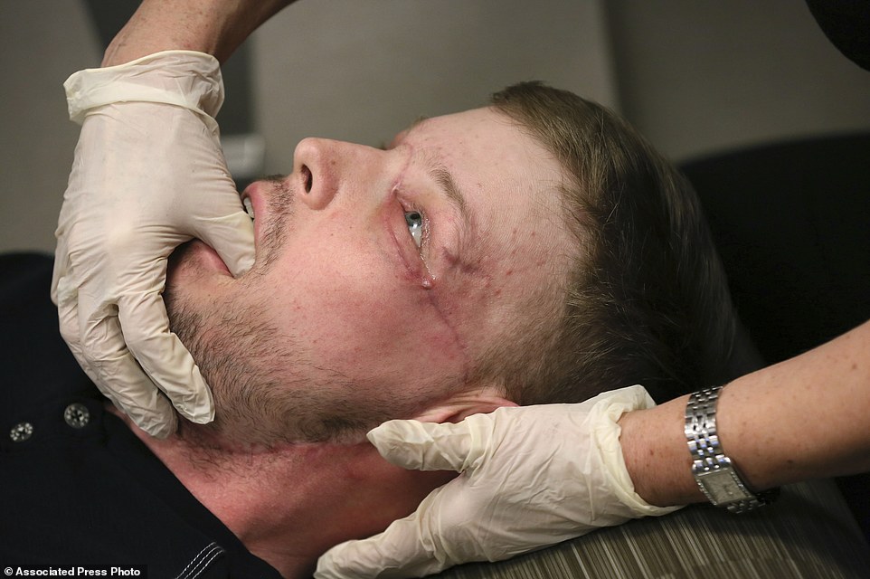 Checkups: Andy Sandness has his face checked during an appointment with physical therapist Helga Smars at Mayo Clinic in Rochester late last month