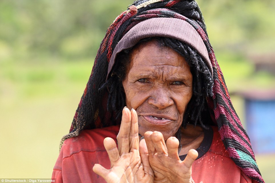 In Indonesia's Dani Village, New Guinea, some women like this one cut off the tips of their fingers when a relative dies