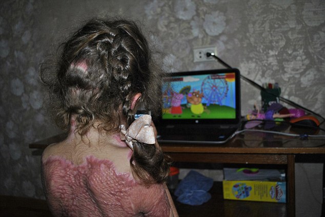 Five-year-old Sofia Ezhova was severely burned after switching on a gas oven after learning of the game, in which she was told she could become a 'fire fairy'