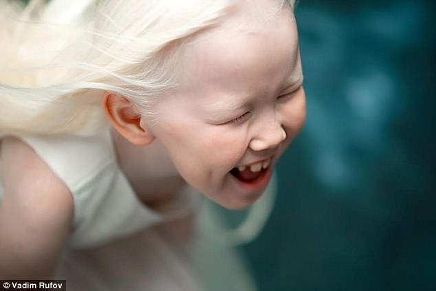 Her parents Elena and Albert say Nariyana is the first albino on either side of the family 