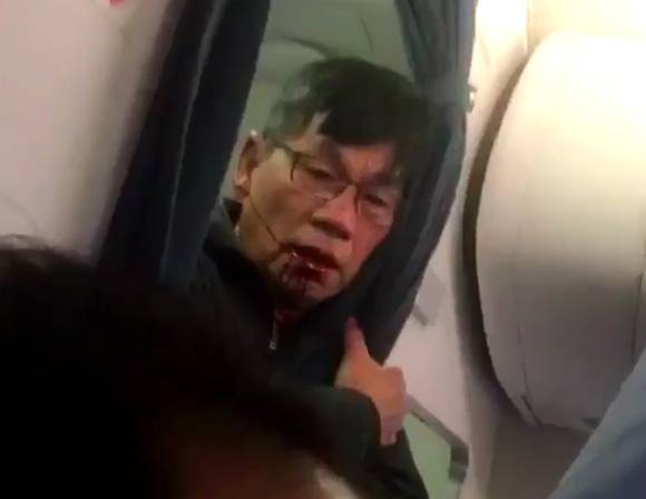 聯航毆打乘客事件中的男子身分曝光！被請下飛機的原因就是因為「票種不一樣」！
