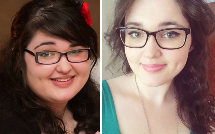 What Losing 60kg Did To My Face