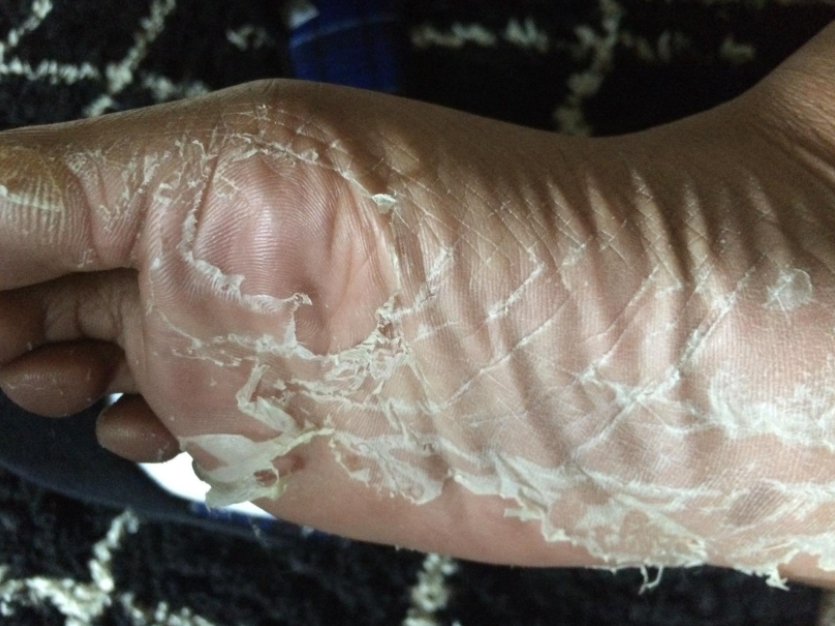 %e5%9c%8b%e5%a4%96%e6%9c%80%e5%a4%af%e8%b6%b3%e8%86%9c%e6%ad%bb%e7%9a%ae%e6%95%b4%e5%a1%8a%e6%92%95%e4%b8%8b