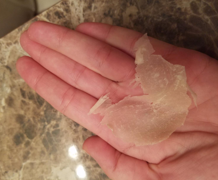 %e5%9c%8b%e5%a4%96%e6%9c%80%e5%a4%af%e8%b6%b3%e8%86%9c%e6%ad%bb%e7%9a%ae%e6%95%b4%e5%a1%8a%e6%92%95%e4%b8%8b