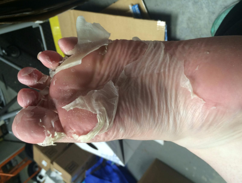 %e5%9c%8b%e5%a4%96%e6%9c%80%e5%a4%af%e8%b6%b3%e8%86%9c%e6%ad%bb%e7%9a%ae%e6%95%b4%e5%a1%8a%e6%92%95%e4%b8%8b