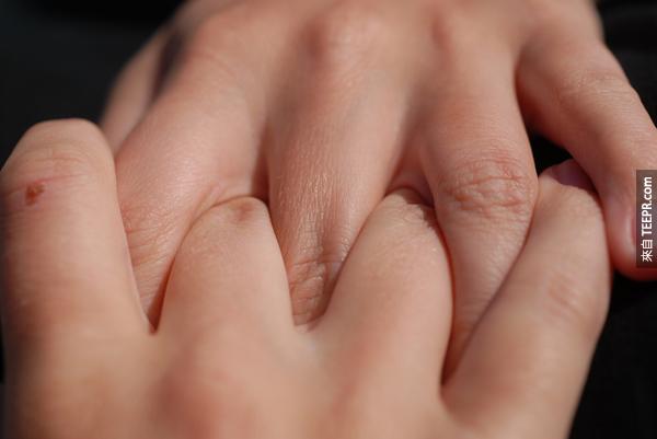 13.) 把手指關節弄得劈啪作響不會給你關節炎。只有年紀、受傷、肥胖，還有基因可以讓你罹患關節炎。