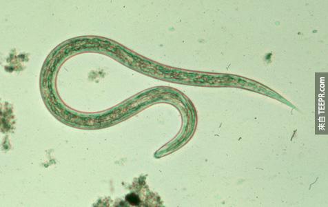 鉤蟲 （ Hookworm  ）– 這種可怕的吸血蟲會寄生在你的腸子裡面，並吸光你的血，讓你缺鐵。