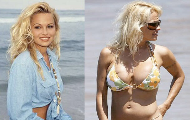 16. 潘蜜拉·安德森(Pamela Anderson)，除了年龄变大，一定还有哪里也变大了...