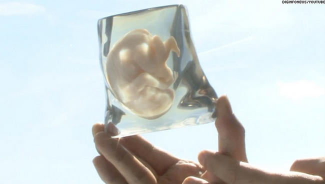 6.) The Fetus Of Your Unborn Child.