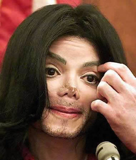 3.  麥可·傑克森(Michael Jackson)：超過10次的鼻子整形手術。