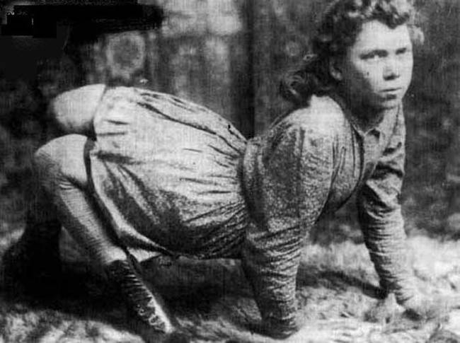 她在1870年出生，1921年去世。在她的一生中，她憑藉著自己腳步天生奇異而在馬戲團表演，一個禮拜大約賺6,100元台幣 ($200美元)。