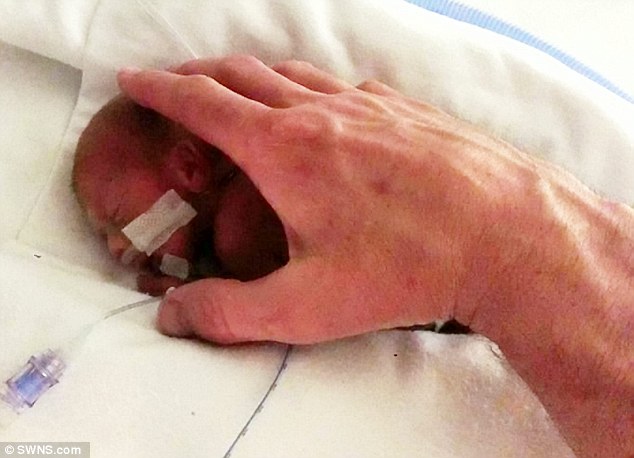 Jett是25週出生的早產兒，只有0.63公斤重，即便媽媽子宮的羊水破了，他還是撐過那5個星期，最後出生。