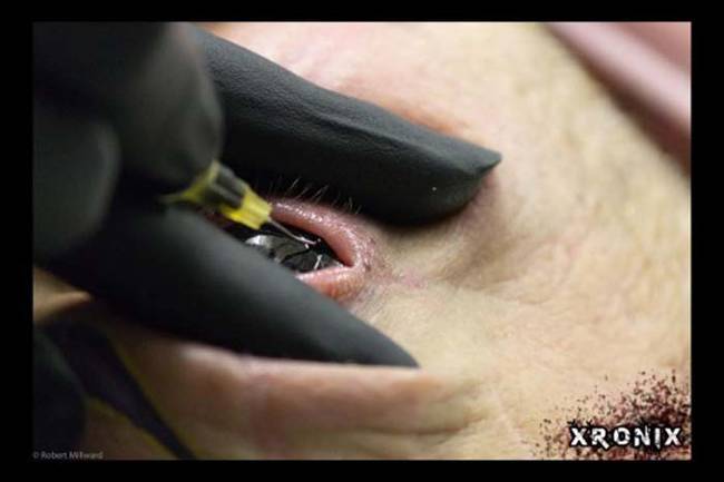 Ouchies. This is what the eyeball tattoo process looks like.