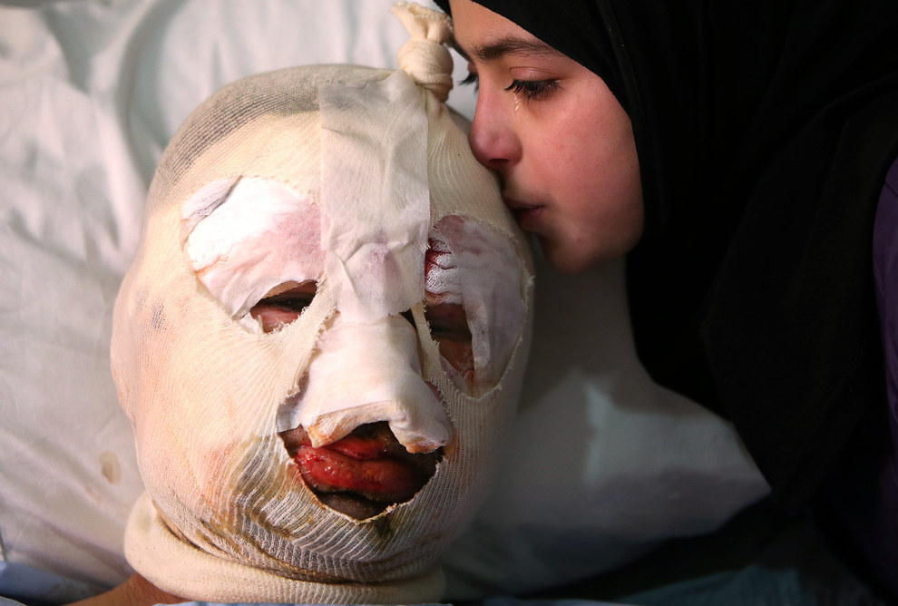 27. 在黎巴嫩與敘利亞的邊界Hermel小鎮，13歲的Fatima正在流淚親吻因爆炸案而受傷的爸爸。