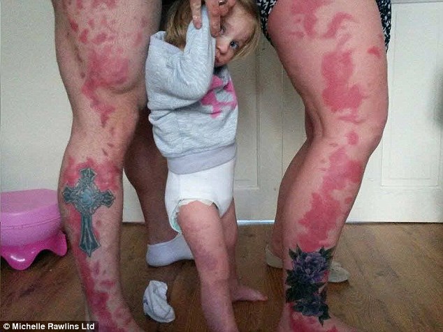 Devotion: Honey-Rae Phillips (centre) was born with a harmless but disfiguring strawberry birthmark - so to show she is just like everyone else, her parents have each had tattoos of the same blotches (left and right)