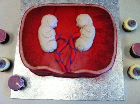 This cake made especially for twins.