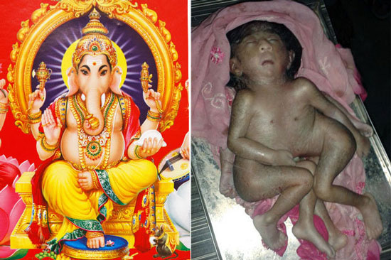 在印度贾坎德邦 (Jharkhand) 诞生了一位有着4只手臂的小男婴，造成了大轰动。因为地方的人民都认为，这是印度教象头神 (Genesha) 的转世。