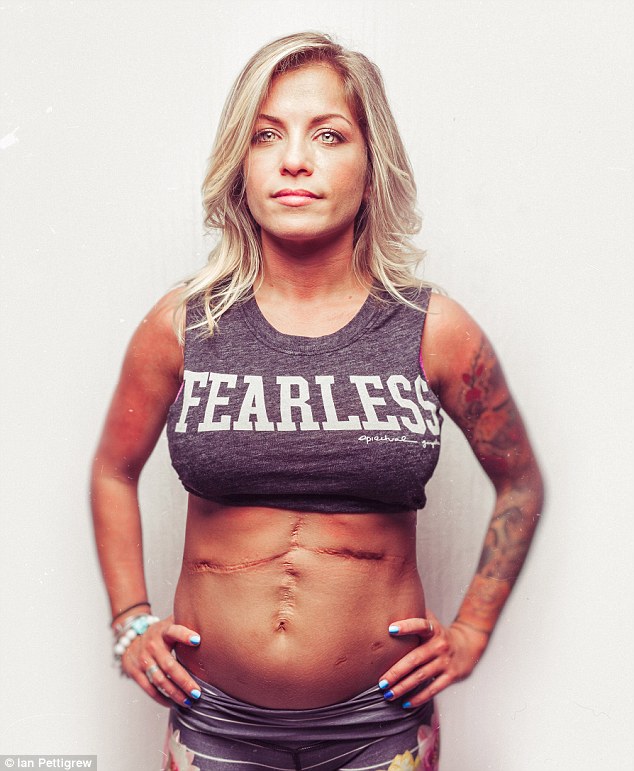 No fear: Another model rolled up her muscle T-shirt to show off her scars, as well as her arm tattoos 