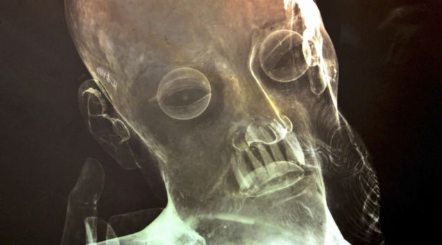 X-Ray Reveals Real Human Teeth in 300-Year-Old Jesus Statue