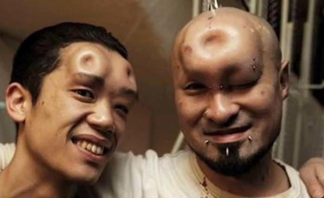 Canadian body modification artist Jerome Abramovitch pioneered the procedure in his native country before it found a home in Japan, where it has become quite popular.