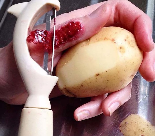 When peeling potatoes goes wrong.