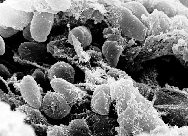 Experts agree that the bacteria<em> Yersinia pestis, </em>which is found on the fleas that live on rodents, was the true cause of the plague.