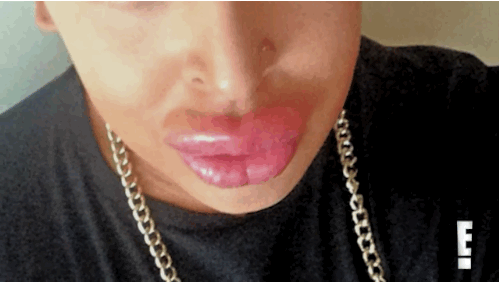 This Guy Spent $150,000 To Look Like Kim Kardashian And Now His Lips Are Leaking