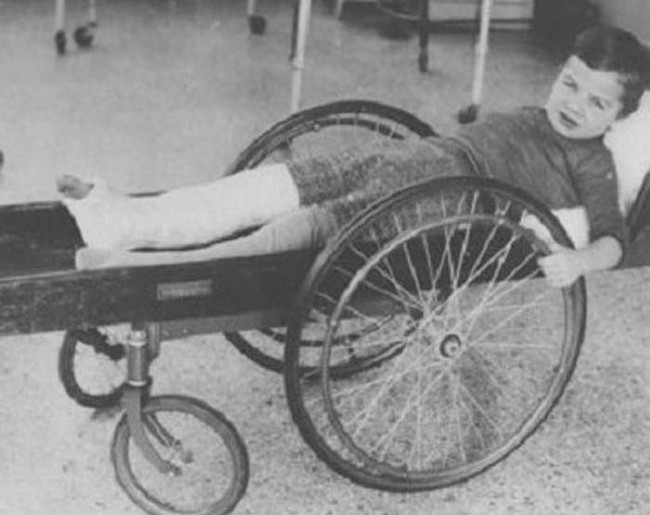 This injured boy is wheeling around in an "invalid cart."